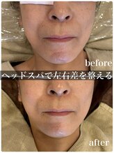 マルコ(marco)/ヘッドスパでリフトアップと小顔