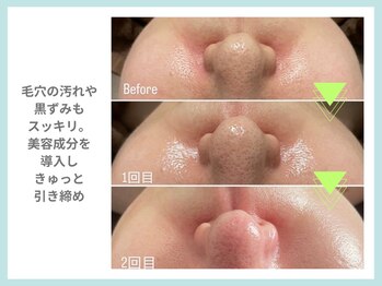 リラクゼーションアンドビューティーボヌール(BONHENR)/最新☆ラミネーションピーリング