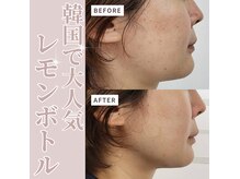 レゾン 京橋店の雰囲気（《最新トレンド美容》たるみケア・小顔が叶うレモンボトル☆）