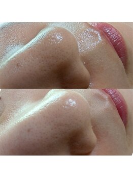 スノードロップ(snowdrop)/