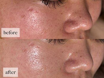 ヒナノ 矢場町店(HINANO)/クリスティーナビオフィート