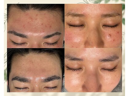 メゾンビューティーポピンズ 恵比寿(maisonbeauty poppins)の写真