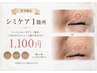 9月限定｜シミケア1箇所(3ミリ以内)　※単体でのご予約は不可