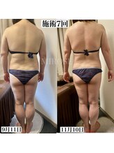 ミローズ(MIROSE)/背中が小さく、シルエット変化♪