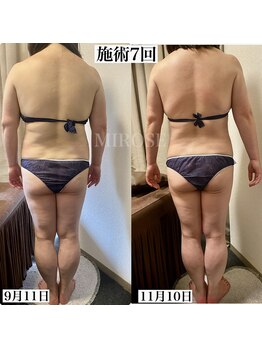 ミローズ(MIROSE)/背中が小さく、シルエット変化♪