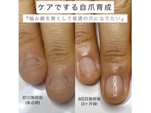 ユメネイル(YUME NAIL)の雰囲気（かみ癖・むしり癖など爪のお悩みから卒業☆お悩みに寄り添います）