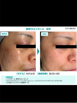 フェローズリンパケア(FELLOWS)/美白メニュー