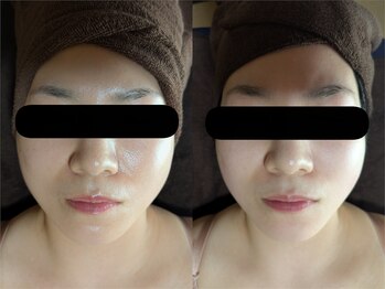 スノードロップ(snowdrop)/