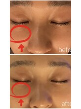 シャンス(Chance)/エンビロンエステ&ピーチリフト