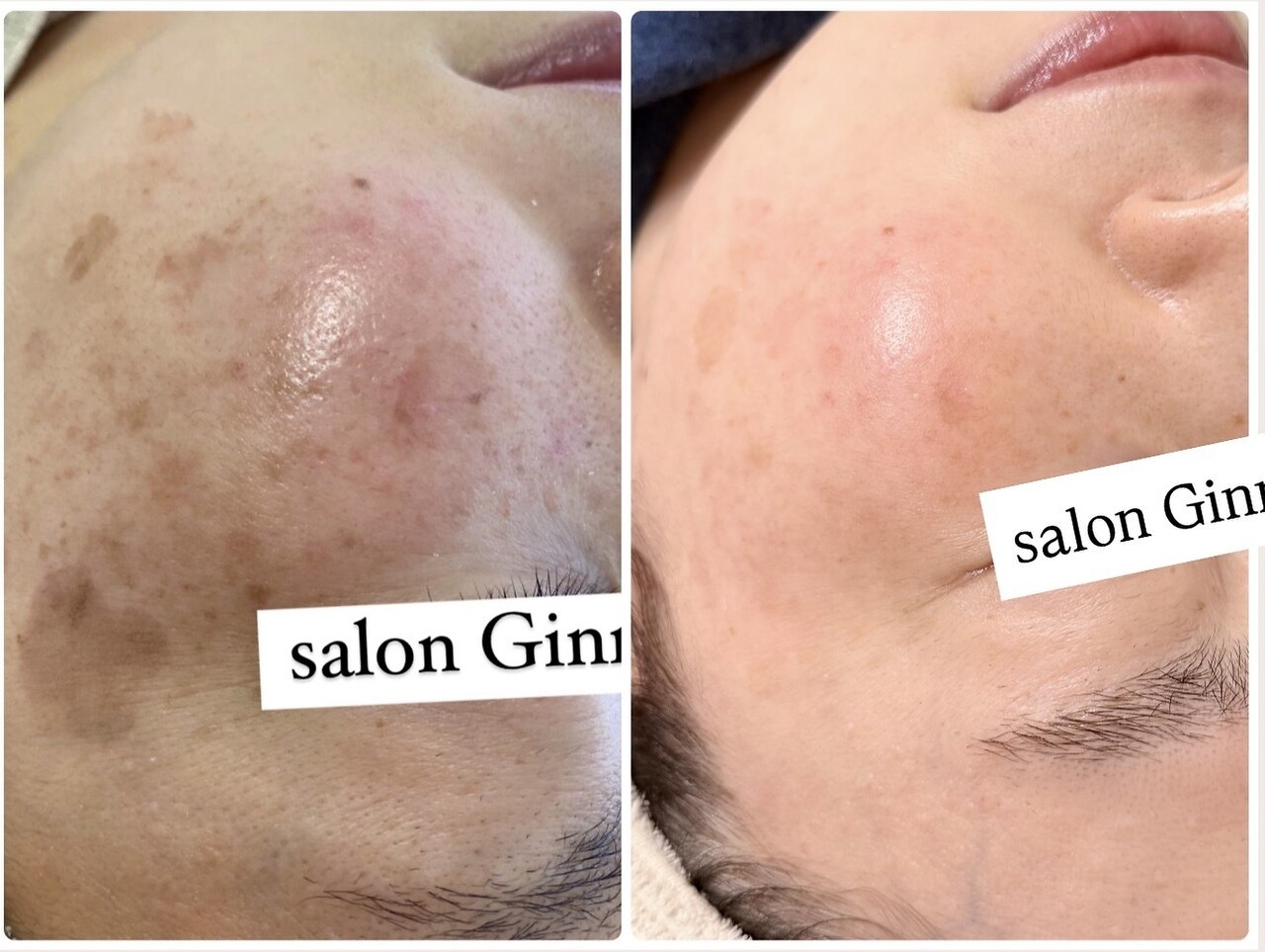 ジーナ(Ginna)｜ホットペッパービューティー