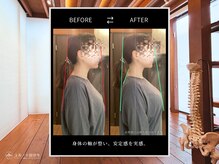 ユルノテ 国分寺/ビフォーアフター1