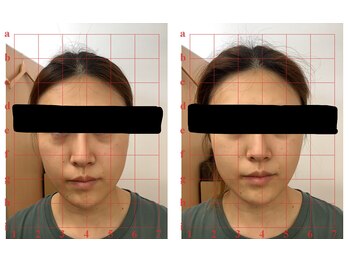 田端整体院/小顔整体アフターが美しい