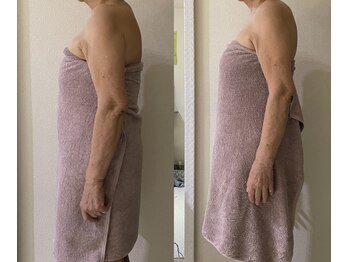 新百合ケ丘の痩身専門エステサロン リリバ(ririva)/筋膜リリース１回施術