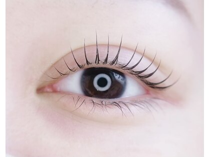 ブリンク(blink)の写真