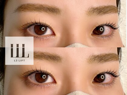 ハル(halu)の写真
