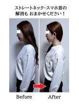 みなと/ストレートネック・スマホ首に◎