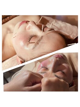 癒縁(YOU enn)/美容鍼×フェイシャル