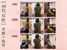サクラ(SAKURA)/【40代】BeforeAfter