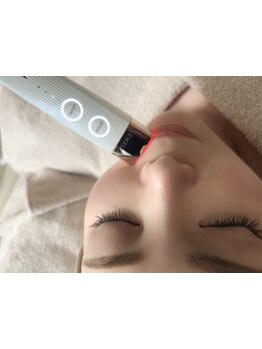 美白ケアをしたい