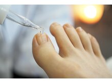 巻き爪/陥入爪/深爪/自爪育成/ハンドケア/フットケア/よもぎ蒸し