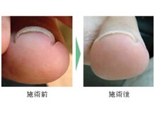 シンシアリー 新小岩店(Sincerely)の雰囲気（巻き爪の爪切り・巻き爪改善）