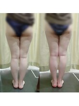 マイフェアレディ 今池(MyFairLady)/圧倒的な効果◆ラフォス高周波