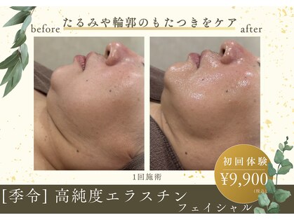 ナチュールファースト(naturel first)の写真