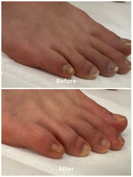 ポップ(POP!!)の写真/手と足のお手入れで爪も肌も滑らか健やかに♪長さ/形が整いケアで滑らかな手肌になるだけで清潔感がUP!!