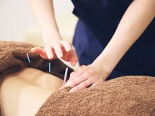 南砂かなで鍼灸 接骨院 南砂町スナモ店/鍼施術
