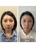 【平日13時→17時限定！】整顔&ヘッド 限定特別メニュー
