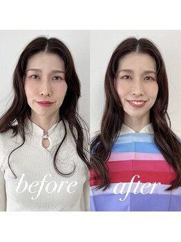 サロン ルシール(Salon lucir)/Before&After