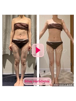 ストーミーストーン(STORMY STONE by Aphros Queen)/やく石浴BASICコース1ヶ月