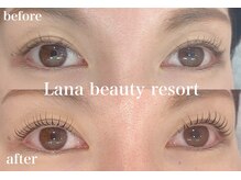 ラナビューティリゾート(Lana Beauty resort)/アップラッシュリフト