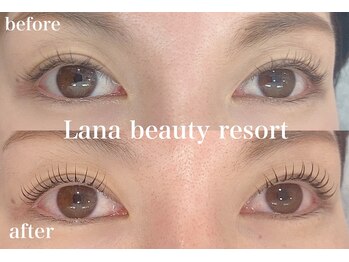 ラナビューティリゾート(Lana Beauty resort)/アップラッシュリフト