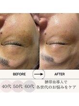 ランプシー(Lampsi)/40代50代60代のお悩み肌に