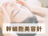 幹細胞マイクロニードル（赤みケア・毛穴ケア・ニキビケア）8000円