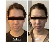 小顔22 ボルティ 本店(Bolty)/小顔シンメトリー矯正＆全身矯正