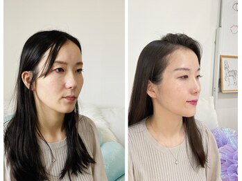 ジブンビューティー(jibun beauty)/ビフォーアフター