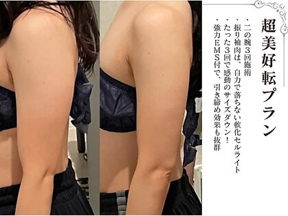 ラブミー 渋谷本店(LoveMe)の写真