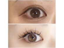 アモ(AMO)/バインドロック