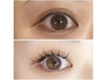 アモ(AMO)/バインドロック