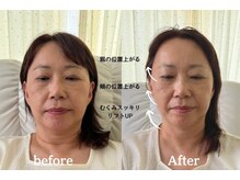 ミラ 中央林間(mira)の雰囲気（引き上げ小顔ケア[小顔/毛穴/ホワイトニング/ハーブピーリング］）