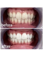 コナホワイトニング 神保町/セルフホワイトニング神保町