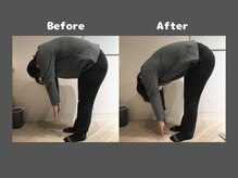 くにたちNyan鍼灸整体院/【整体】Before After 4