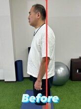 サンライズスポーツアカデミー(Sunrise Sports Academy)/ストレッチ整体*Before