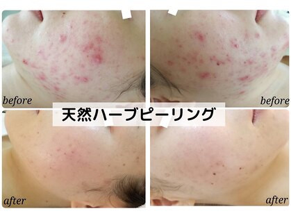 マルコ(MARCO)の写真