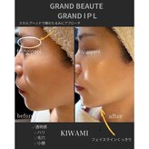 フランジパニ(FRANGIPANI)