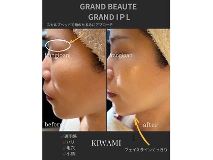 フランジパニ(FRANGIPANI)の写真