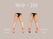 ハネ 自由が丘(Hane)/[自由が丘/インディバ/術後ケア]