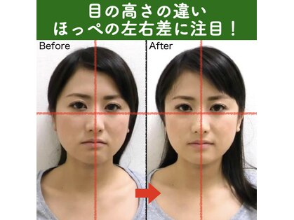 美容整体すこやかの写真